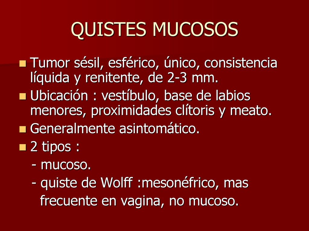 quiste labios mayores vulva